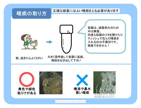 痰培養 採取方法 吸引 看護|喀痰の検査を受けられる方へ